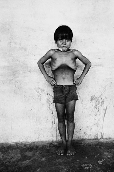 Roger BallenBlown up boy, East Malaysia, 1976aus der Serie Boyhood© Roger Ballen