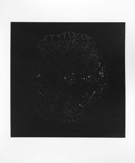 Esther MATHISUntitled 02, 2013Gelatin Silver Print of a blood sampleimage 33,7 x 28,7 cm ( 13 1/4 x 11 1/4 in. )Edition of 3, 1 AP