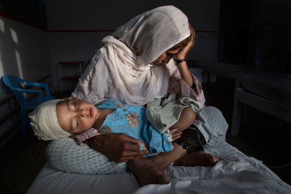 © Paula Bronstein: The Silent Victims of a Forgotten WarGetty Images Reportage for Pulitzer Center on Crisis Reporting2017 Photo Contest, Daily Life, Singles, 1st prize29 March, 2016; Najiba holds her nephew Shabir (2), who was injured in a bomb blast that killed his sister, in Kabul, Afghanistan, in March. The bomb exploded in a relatively peaceful part of Kabul while Shabir’s mother was walking the children to school.