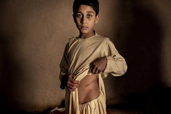 Asia StoriesThe Price of Peace in Afghanistan© Mads Nissen, Politiken/Panos Pictures