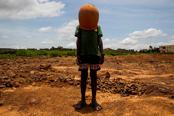 © Fatoumata DIABATÉ,
J’ai été brûlé vif, 2024 
courtesy de l’artiste et Photo Days