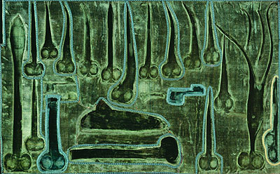 © Sinje Dillenkofer»CASE 27«, diptych, 2005Ilfochrome, Diasec, wooden frame,each je 60 x 98 x 5 cm / 23,6 x 38,6 x 2 inch(lid and bottom: »XLVI MISCELLANEA«, box for surgical instruments constructed under Emperor Josef II, Josephinum of the Medical University, Vienna)