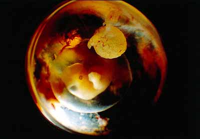 Ein sechs Wochen alter Embryo schwimmt im Fötussack.Bildrechte: ZDF