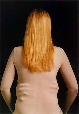 Année Olofsson Skinned, 2002150 x 120 cmCourtesy of the artist andMia Sundberg Galleri, Stockholm