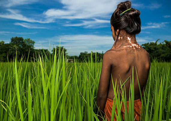 Brent Stirton, 2013. From the series: Burns Capital Of The World, 2013 © Brent Stirton, Prix Pictet