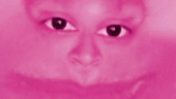 VIRAL HALLUCINATIONS SYMPOSIUM #2
